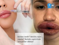 Botoks nedir? Botoks nasıl yapılır? Botoks yaptırmak isteyenler dikkat!