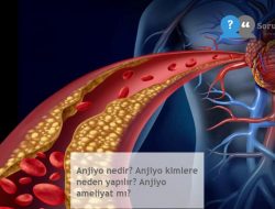 Anjiyo nedir? Anjiyo kimlere neden yapılır? Anjiyo ameliyat mı?