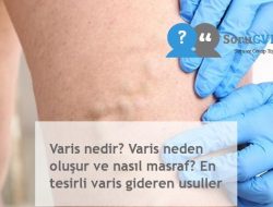 Sol Bacakta Varis Belirtileri ve Bacakta İç Varis Belirtileri Nelerdir?
