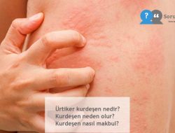Ürtiker kurdeşen nedir, neden olur [Etkili Yok Etme]