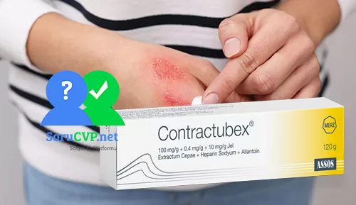 Contractubex eski izleri geçirir mi?