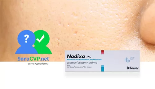 Nadixa krem gözeneklere iyi gelir mi?